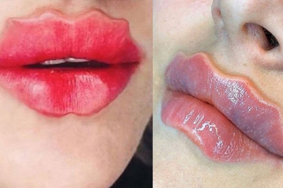 "Đavolje usne" najnoviji trend ljepote