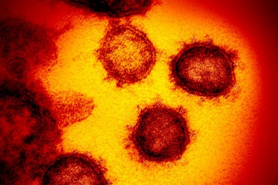 Širenje virusa ide prije simptoma, nakon 10 dana nema prenosa zaraze?