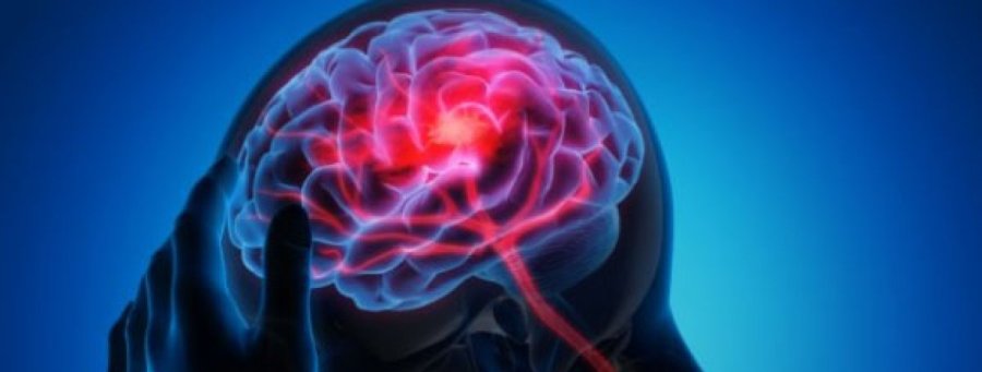 Koji su najčešći uzroci migrena i glavobolja?